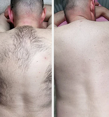 STEFAN M., 38
