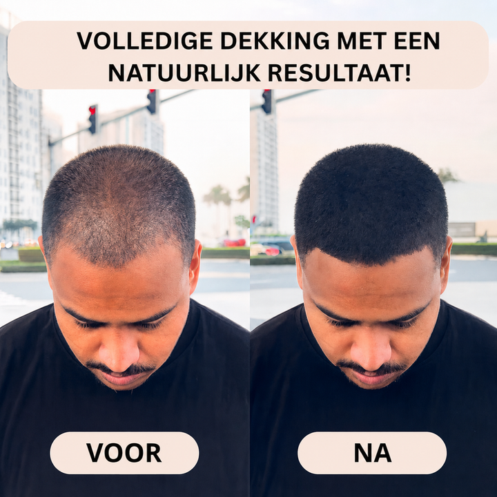 Noveau™ - Volume &amp; Haarvezel Concealer