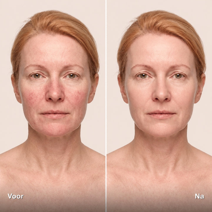Noveau™ Kleurcorrigerend CC Serum