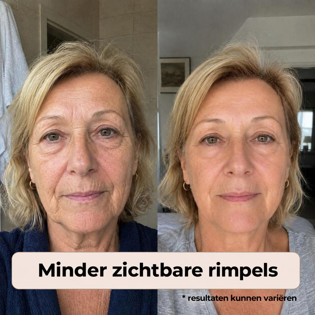 Noveau™ - Rimpel Correctie Crème