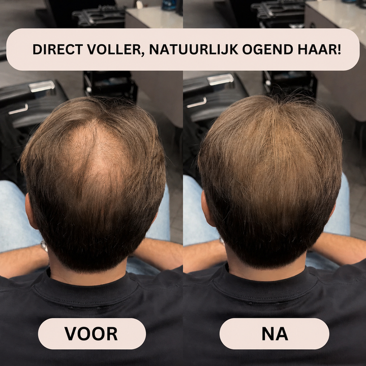 Noveau™ - Volume &amp; Haarvezel Concealer