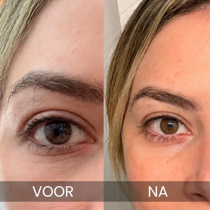Noveau™ - Koreaanse Oogbalsem tegen Donkere Kringen