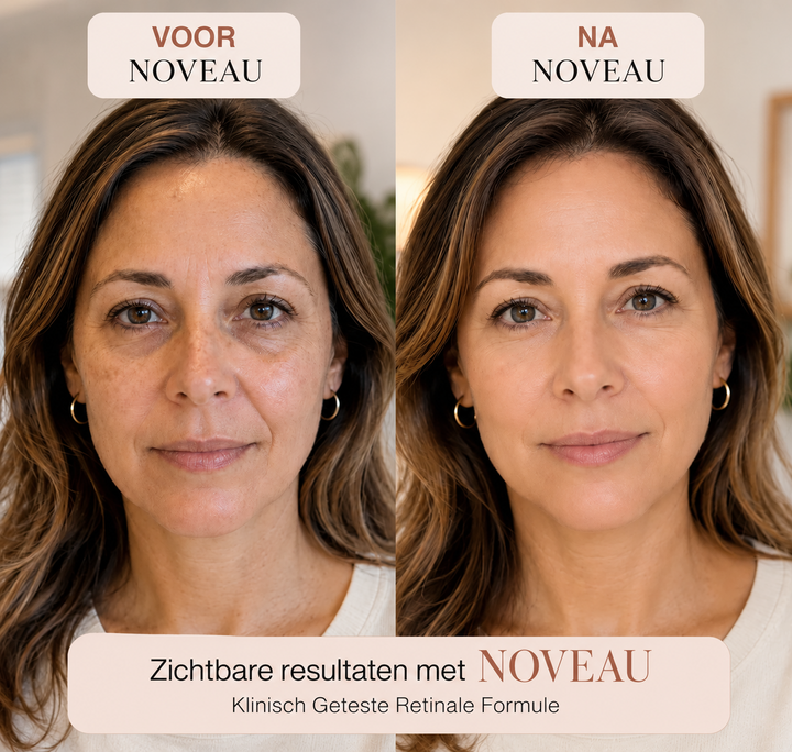 Noveau™ Koreaanse Retinal Rimpelbooster