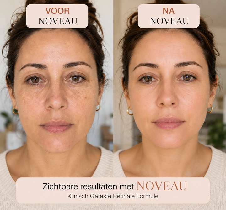 Noveau™ Koreaanse Retinal Rimpelbooster