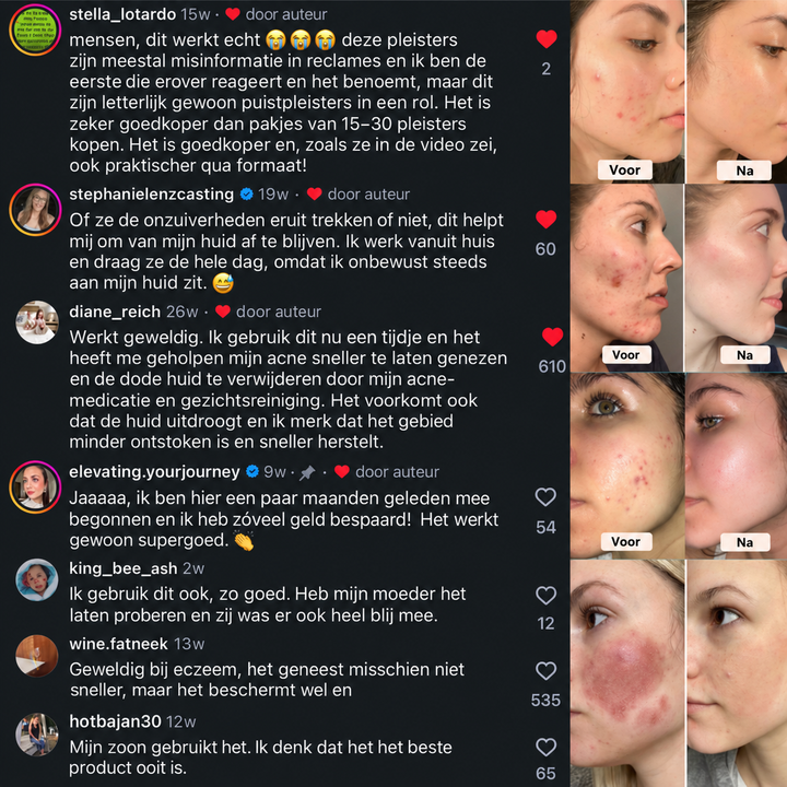 Noveau™ Puistjespleister op Rol