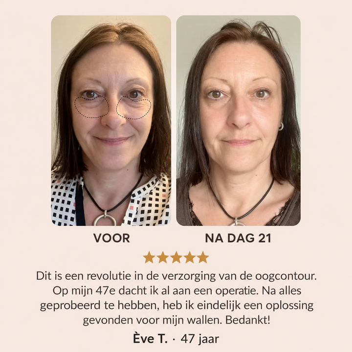 Noveau™ Ooglift &amp; Glow Pen